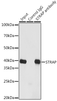 [KO Validated] STRAP Rabbit polyclonal antibody