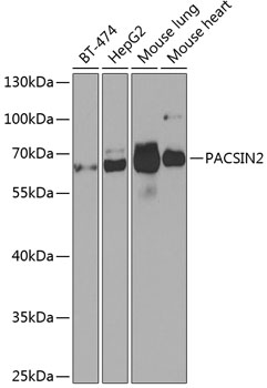 PACSIN2 Rabbit polyclonal antibody