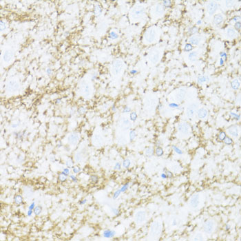 CNPase Rabbit polyclonal antibody