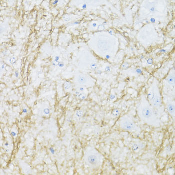 CNPase Rabbit polyclonal antibody