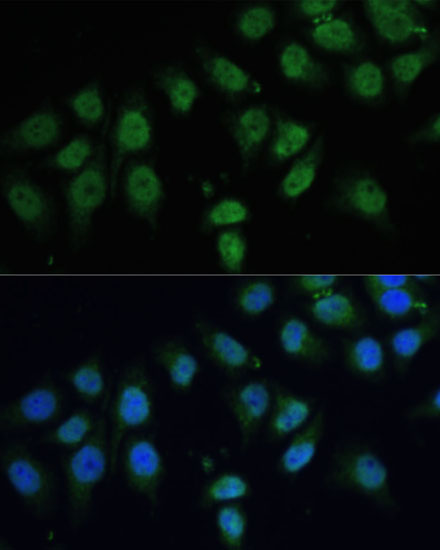 CPS1 Rabbit polyclonal antibody