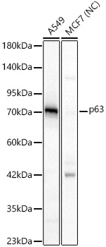 p63 Rabbit polyclonal antibody
