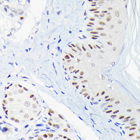 p63 Rabbit polyclonal antibody