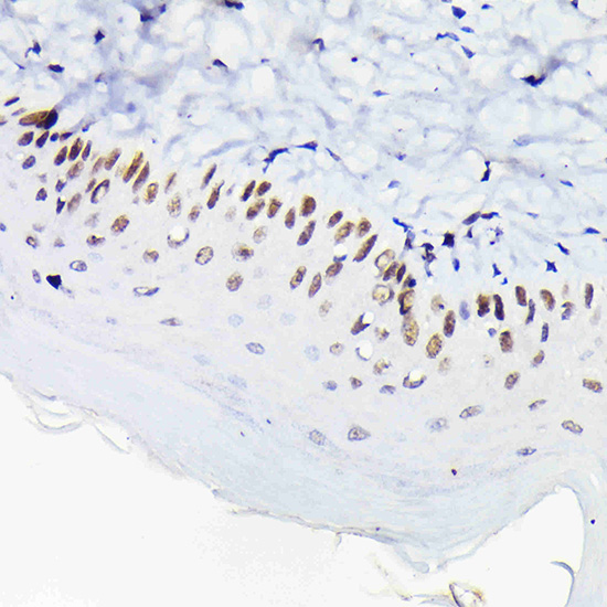p63 Rabbit polyclonal antibody