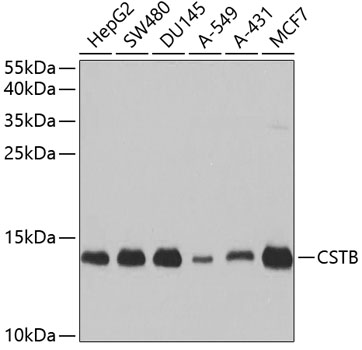 CSTB Rabbit polyclonal antibody
