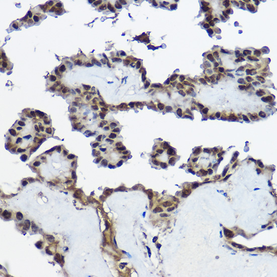 CSTB Rabbit polyclonal antibody