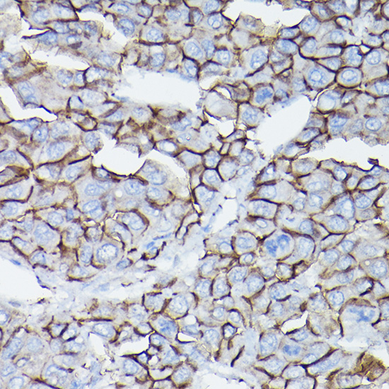 D Delta-Catenin/p120 Catenin Rabbit polyclonal antibody