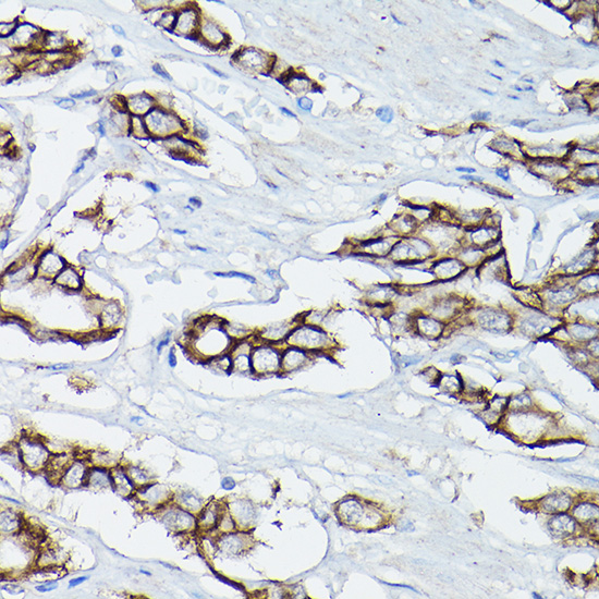 D Delta-Catenin/p120 Catenin Rabbit polyclonal antibody