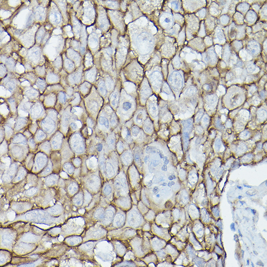 D Delta-Catenin/p120 Catenin Rabbit polyclonal antibody