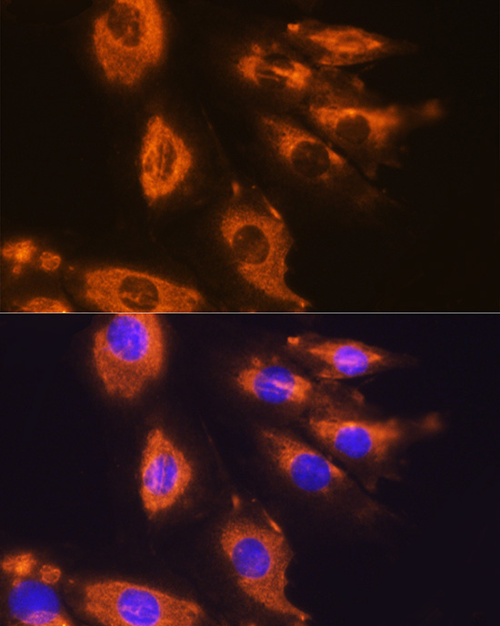 DAG1 Rabbit polyclonal antibody