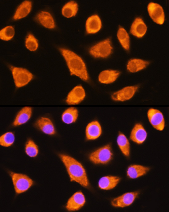 DAG1 Rabbit polyclonal antibody