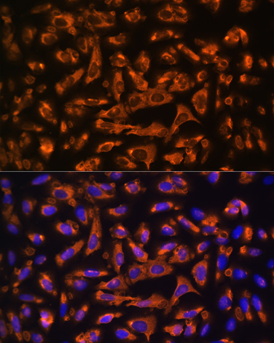 DAG1 Rabbit polyclonal antibody