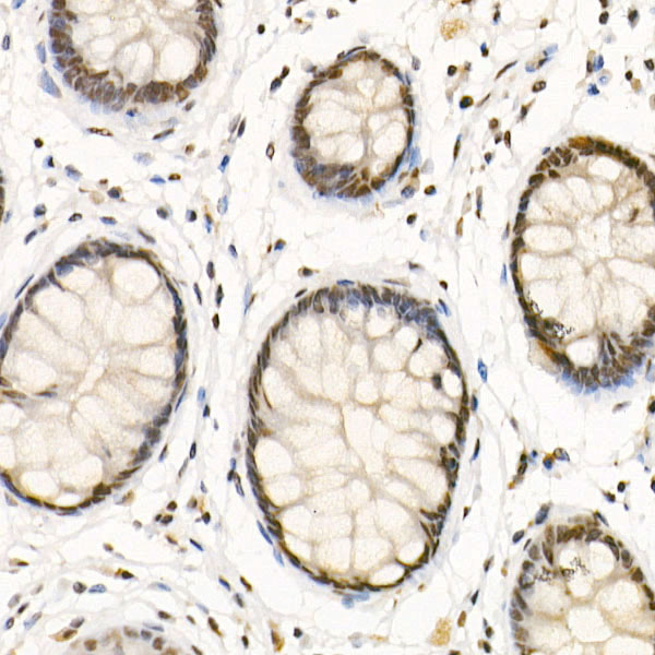 HDAC3 Rabbit polyclonal antibody