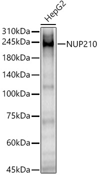 NUP210 Rabbit polyclonal antibody
