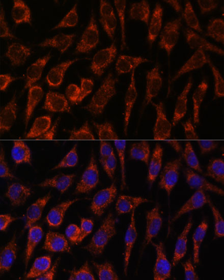 NUP210 Rabbit polyclonal antibody