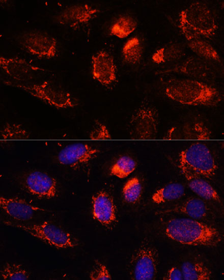 NUP210 Rabbit polyclonal antibody