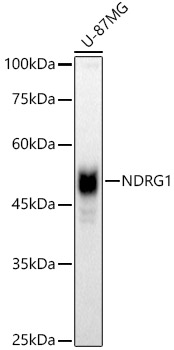 [KO Validated] NDRG1 Rabbit polyclonal antibody