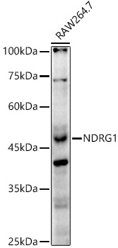 [KO Validated] NDRG1 Rabbit polyclonal antibody