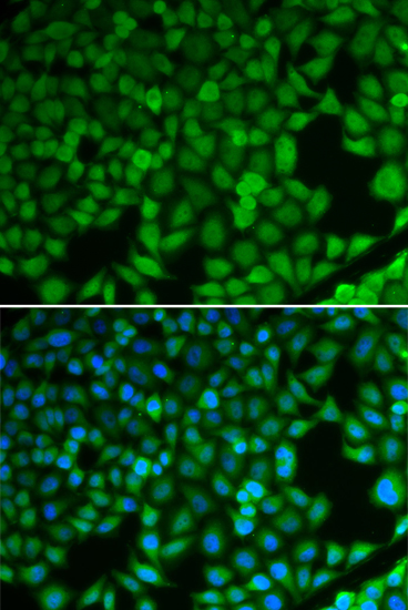 [KO Validated] NDRG1 Rabbit polyclonal antibody