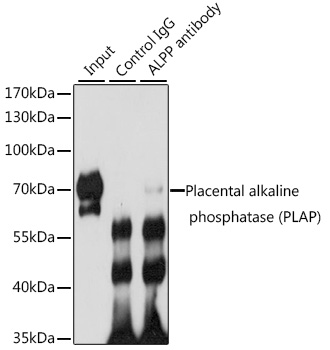 Placental alkaline phosphatase (PLAP) Rabbit polyclonal antibody