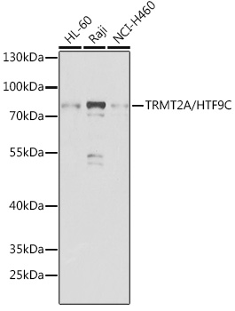 TRMT2A/HTF9C Rabbit polyclonal antibody