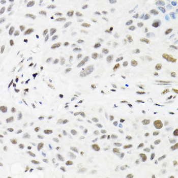 TRMT2A/HTF9C Rabbit polyclonal antibody