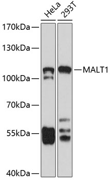 MALT1 Rabbit polyclonal antibody