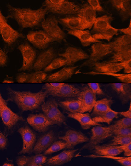 MALT1 Rabbit polyclonal antibody