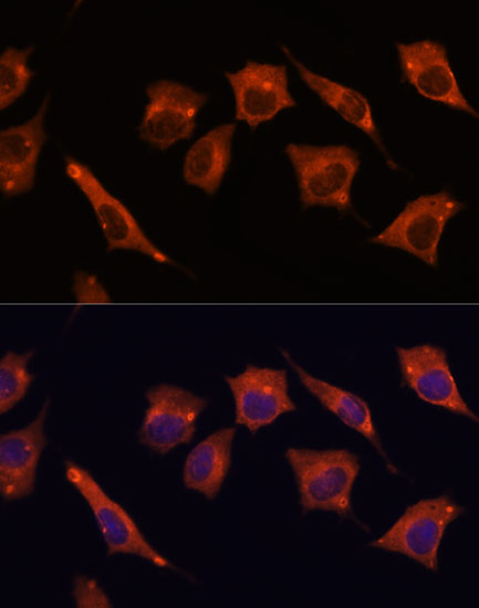 MALT1 Rabbit polyclonal antibody