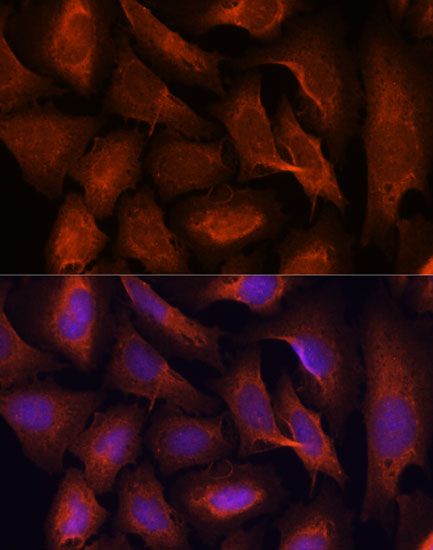 MALT1 Rabbit polyclonal antibody