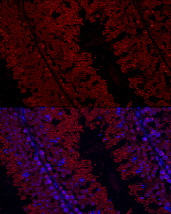 [KD Validated] GPX4 Rabbit polyclonal antibody