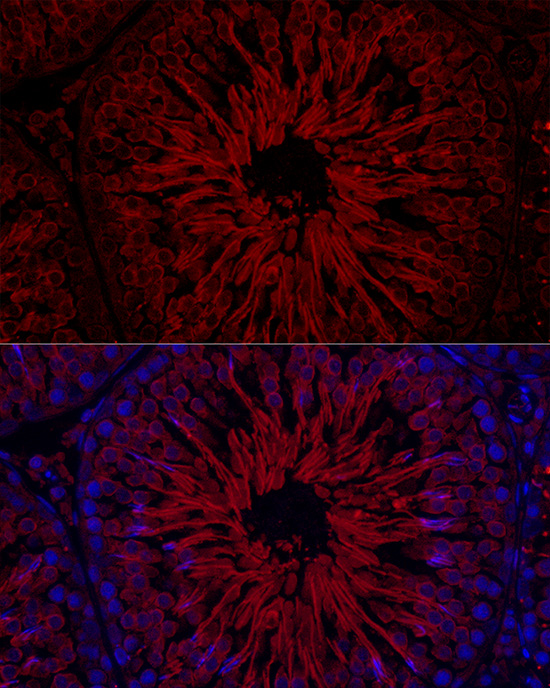 [KD Validated] GPX4 Rabbit polyclonal antibody