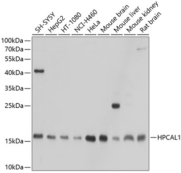 HPCAL1 Rabbit polyclonal antibody