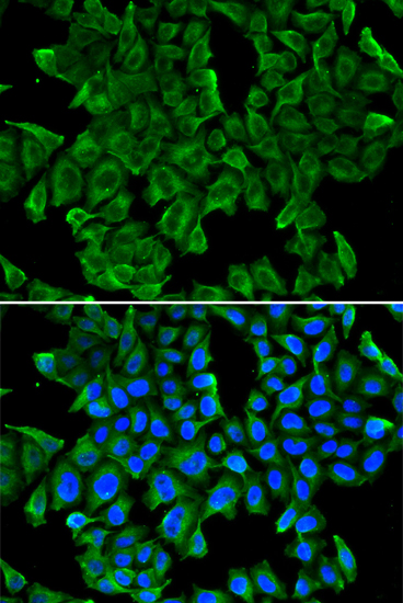 REG3G Rabbit polyclonal antibody