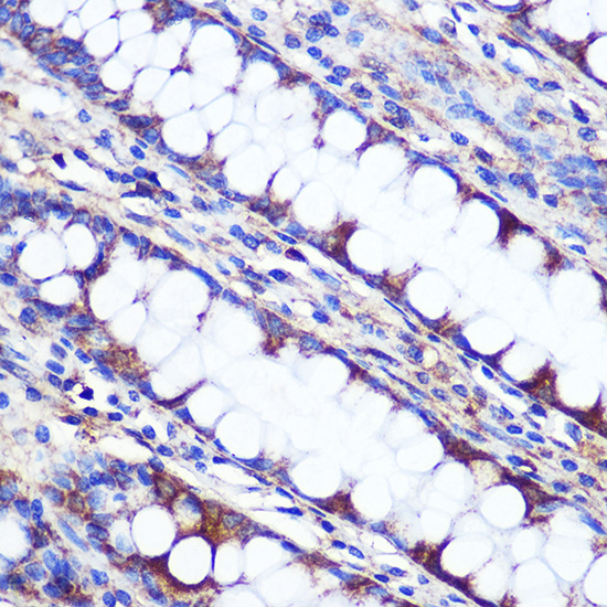 LETMD1 Rabbit polyclonal antibody