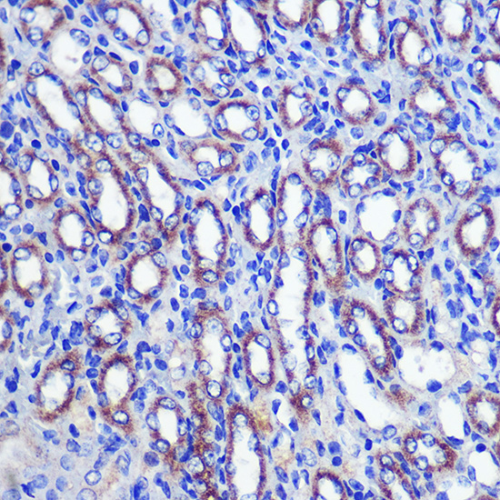LETMD1 Rabbit polyclonal antibody
