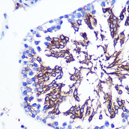 LETMD1 Rabbit polyclonal antibody