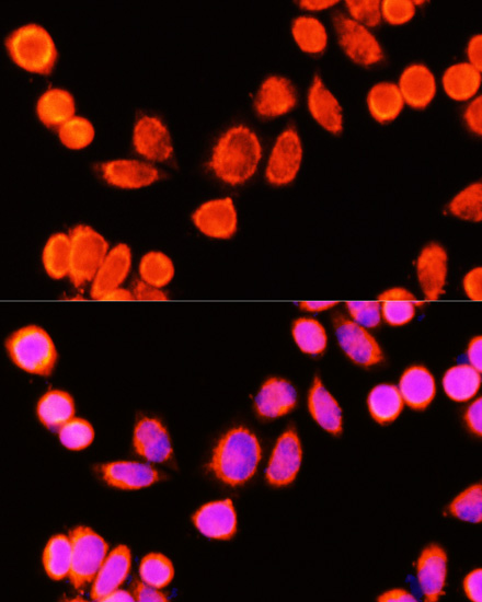 [KO Validated] GSTK1 Rabbit polyclonal antibody