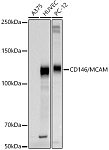 Western blot - CD146/MCAM Rabbit pAb (A21488)
