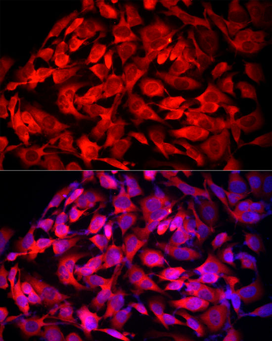 MTAP Rabbit polyclonal antibody