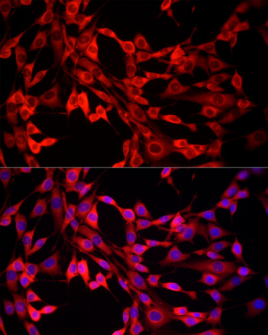 MTAP Rabbit polyclonal antibody