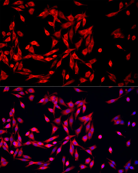 MTAP Rabbit polyclonal antibody