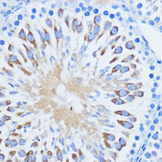 PIWIL1 Rabbit polyclonal antibody