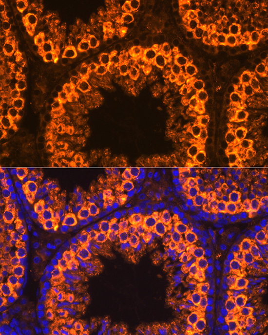 PIWIL1 Rabbit polyclonal antibody