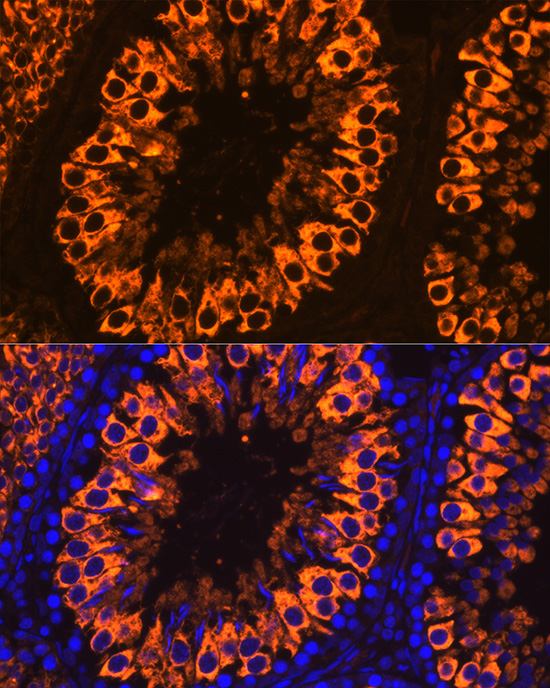 PIWIL1 Rabbit polyclonal antibody