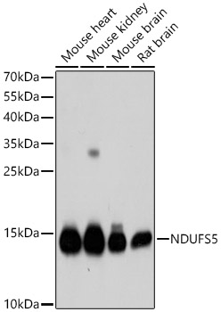 [KD Validated] NDUFS5 Rabbit polyclonal antibody