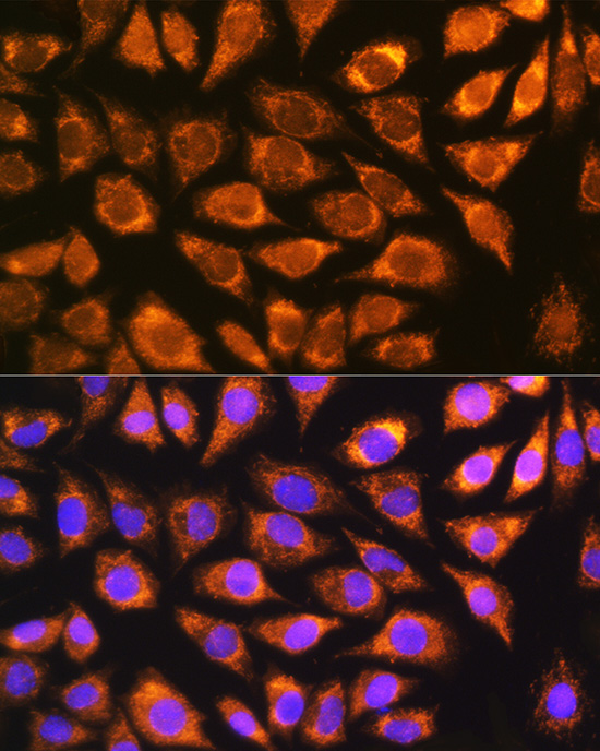 [KD Validated] NDUFS5 Rabbit polyclonal antibody