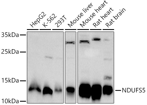 NDUFS5 Rabbit polyclonal antibody