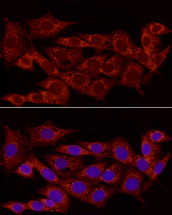 NDUFS5 Rabbit polyclonal antibody