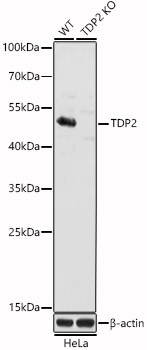 [KO Validated] TDP2 Rabbit polyclonal antibody